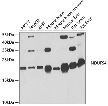NDUFS4 Polyclonal Antibody