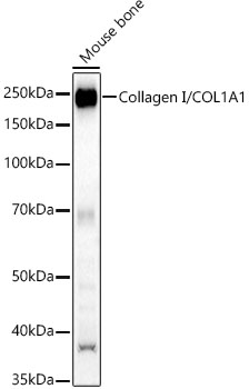 Collagen I/COL1A1 Polyclonal Antibody