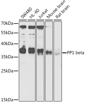 PP1 beta Polyclonal Antibody