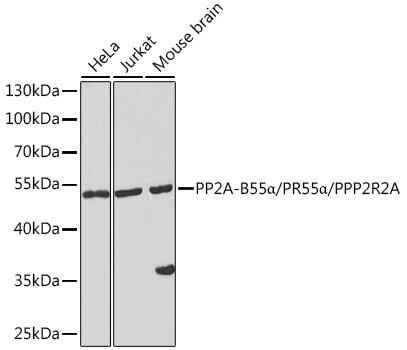 PP2A-B55a/PR55a/PPP2R2A Polyclonal Antibody