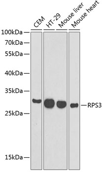 RPS3 Polyclonal Antibody