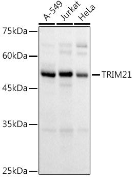 TRIM21/SS-A Polyclonal Antibody