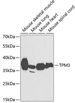 TPM3 Polyclonal Antibody