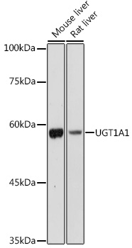 UGT1A1 Polyclonal Antibody