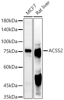 ACSS2 Polyclonal Antibody