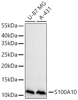 S100A10 Monoclonal Antibody [6X8F7]