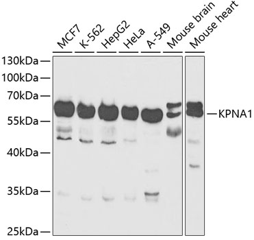 KPNA1 Polyclonal Antibody