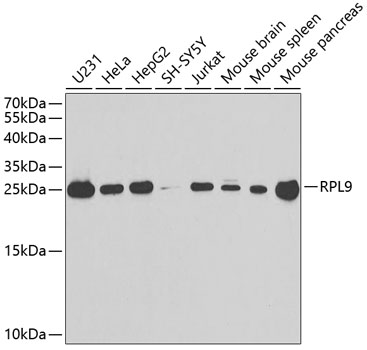 RPL9 Polyclonal Antibody