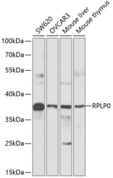 RPLP0 Polyclonal Antibody