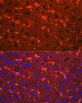 Ceruloplasmin Polyclonal Antibody