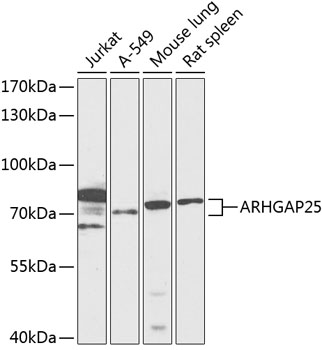 ARHGAP25 Polyclonal Antibody