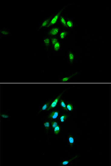 Glucocorticoid Receptor Polyclonal Antibody