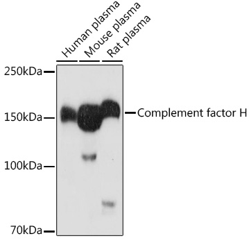 Complement factor H Polyclonal Antibody