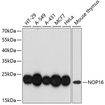 NOP16 Polyclonal Antibody