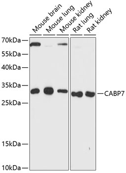 CABP7 Polyclonal Antibody