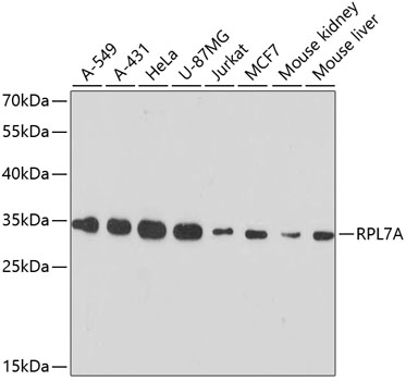 RPL7A Polyclonal Antibody