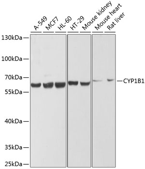 CYP1B1 Polyclonal Antibody