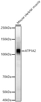 ATP1A2 Polyclonal Antibody