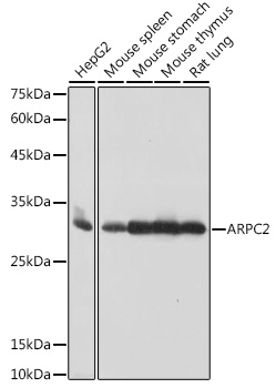 ARPC2 Monoclonal Antibody [4F2G6]