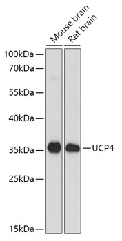 SLC25A27 Polyclonal Antibody