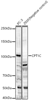CPT1C Polyclonal Antibody