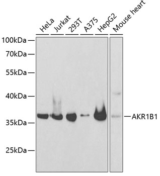AKR1B1 Polyclonal Antibody