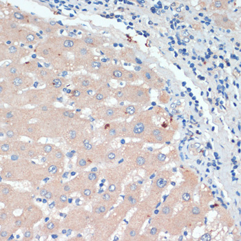 DBH Polyclonal Antibody