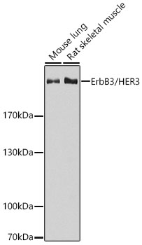 ErbB3/HER3 Polyclonal Antibody
