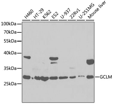 GCLM Polyclonal Antibody