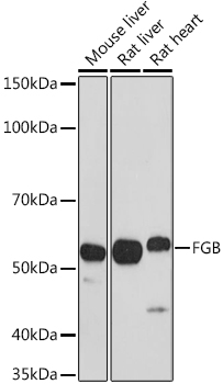 FGB Polyclonal Antibody