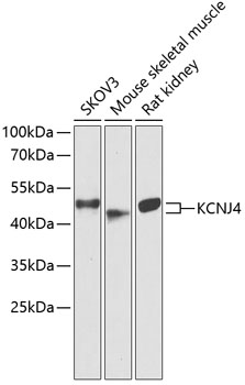 KCNJ4 Polyclonal Antibody