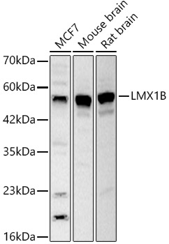 LMX1B Polyclonal Antibody