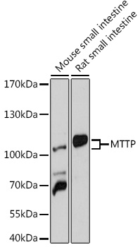 MTTP Polyclonal Antibody