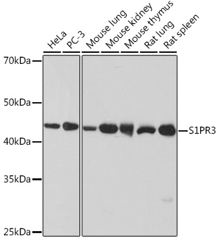 S1PR3 Monoclonal Antibody [5E3G9]