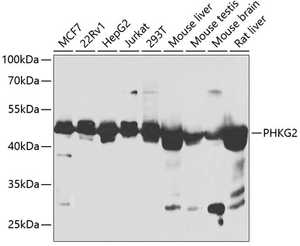 PHKG2 Polyclonal Antibody