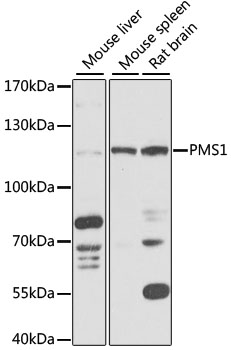 PMS1 Polyclonal Antibody