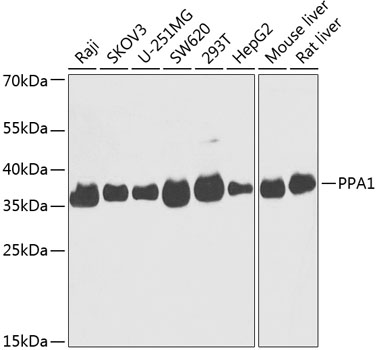 PPA1 Polyclonal Antibody