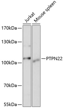 PTPN22 Polyclonal Antibody
