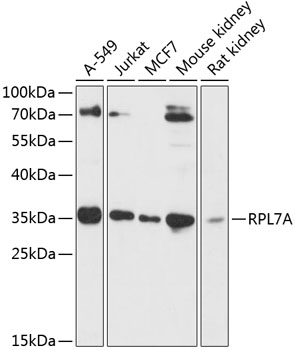 RPL7A Polyclonal Antibody