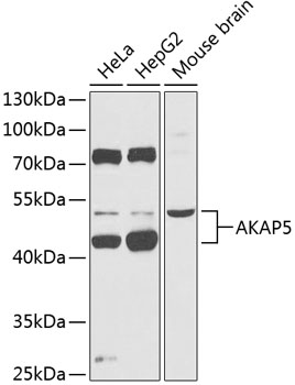 AKAP5 Polyclonal Antibody