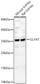 GLYAT Polyclonal Antibody