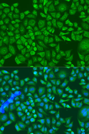 IGF2BP2/IMP2 Polyclonal Antibody