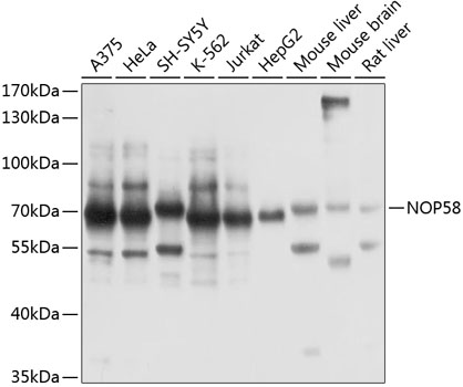 NOP58 Polyclonal Antibody
