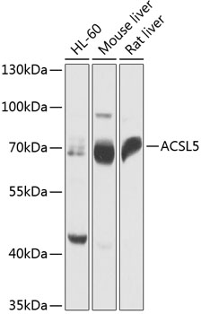 ACSL5 Polyclonal Antibody&nbsp;<img src="images/icon_newarrival.gif" alt="new" border="0">
