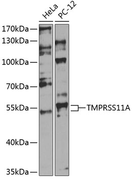 TMPRSS11A Polyclonal Antibody