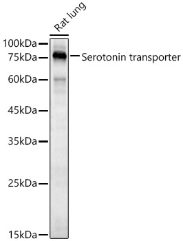 Serotonin transporter Polyclonal Antibody