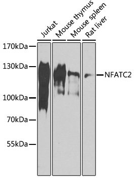 NFATC2 Polyclonal Antibody