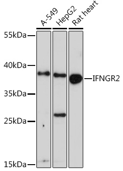 IFNGR2 Polyclonal Antibody