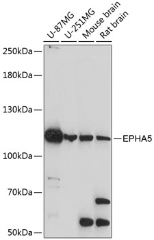 EPHA5 Polyclonal Antibody