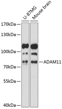 ADAM11 Polyclonal Antibody&nbsp;<img src="images/icon_newarrival.gif" alt="new" border="0">